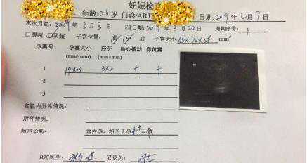 试管婴儿最全详细流程 患有输卵管堵塞怎么办_广州治疗不孕不育较好的医院