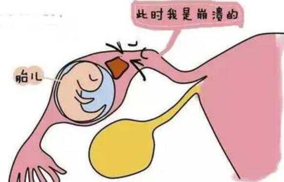 天津供卵卵泡 天津武警医院做试管婴儿怎么样? ‘如何怀孕症状看男女’
